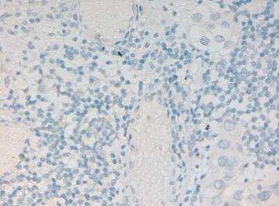 Immunohistochemistry-Paraffin: Histone H2Av [p Ser137] Antibody [NBP1-78103]
